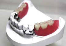 Как привыкнуть к зубным протезам